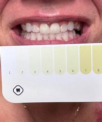 Review image from strips-review-118
